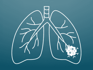 Ecosense EB100 EcoBlu, Home Radon Detector, Capture & Display Results Every 10 Minutes, Short & Long-Term Continuous Monitoring, Easy to Use